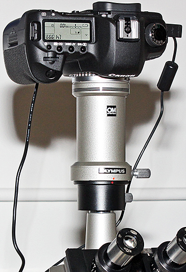 Canon EOS 5D Mark II on an Olympus BH compound microscope