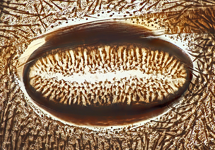 Spiracle of cinnabar moth caterpillar
