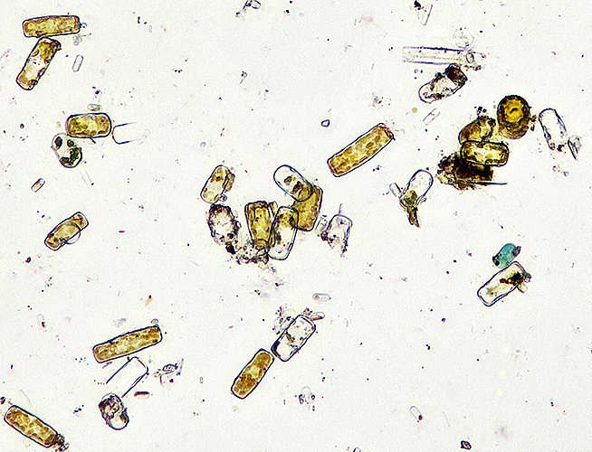 Diatoms from brown slime